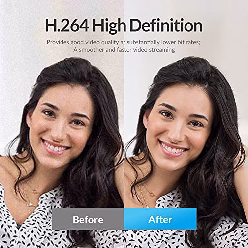 Angetube Full HD 1080p Webcam Luce ad Anello Regolabile Incorporata e Telecamera web in Streaming con Messa a Fuoco Automatica Avanzata per Xbox One Gamer Facebook e YouTube Streamer